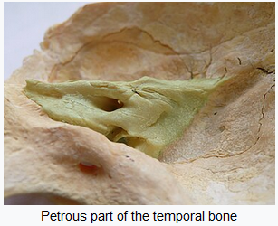 Photo of the Petrous part of the temporal bone